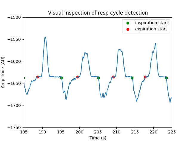 Visual inspection of resp cycle detection