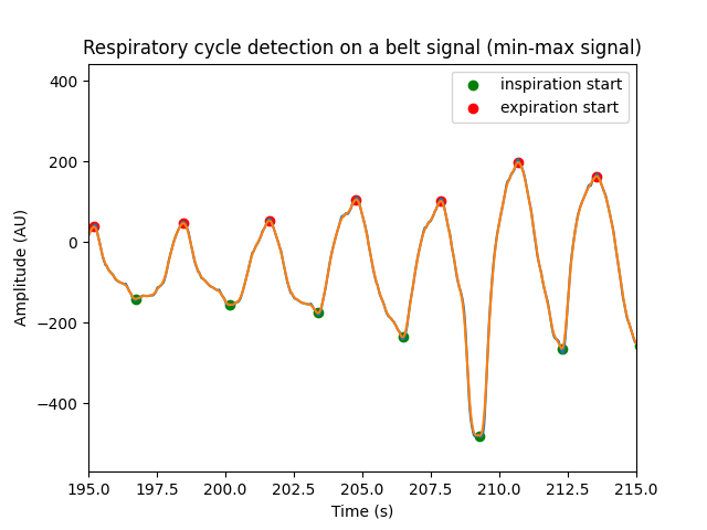 Respiratory cycle detection on a belt signal (min-max signal)