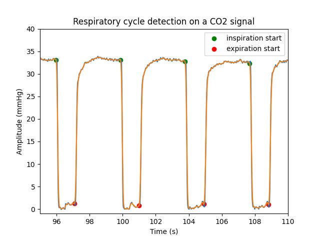 Respiratory cycle detection on a CO2 signal